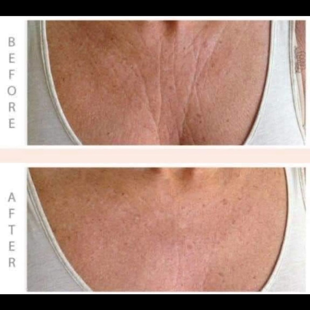 Dermatic Effects - Picture 4 of 4